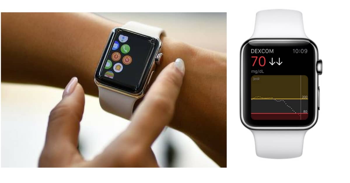 appleWatch-diabete-diagnosi
