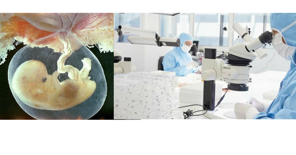 cellule-staminali-placentari