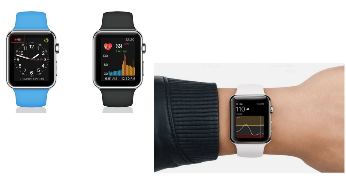 apple-watch-cardio-diabete