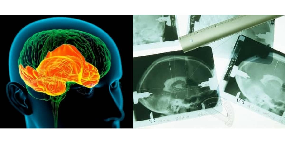 come-stimolare-la-memoria