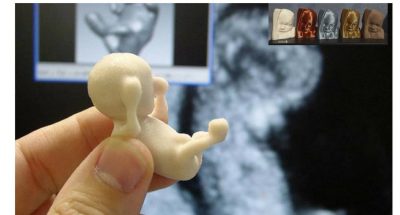 feto-stampato