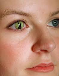 images-lenti-raggi-laser