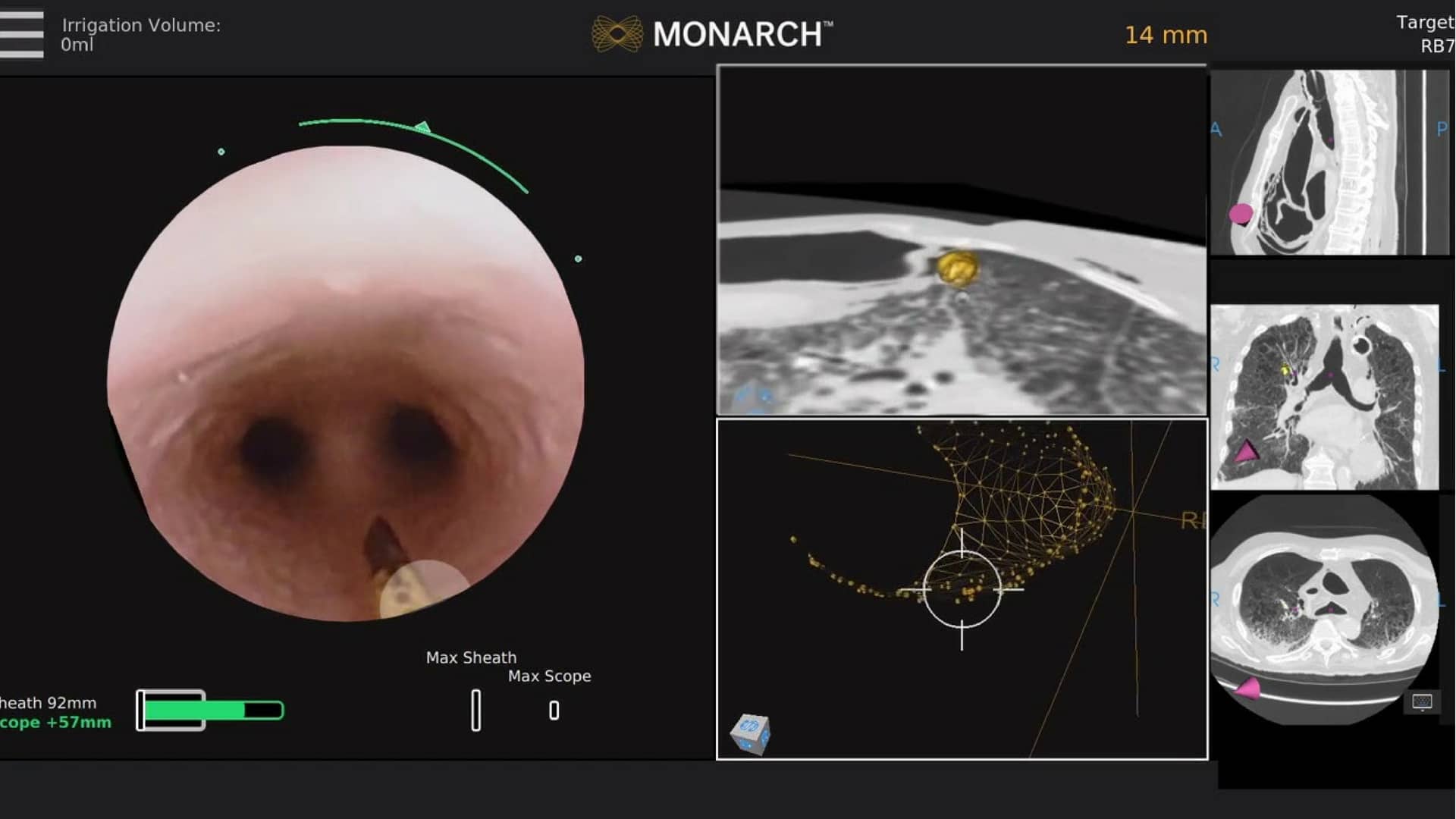 auris-health-robot