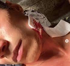 Aggressione a Milano