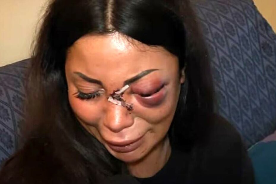 Martina Mucci sfregiata Prato