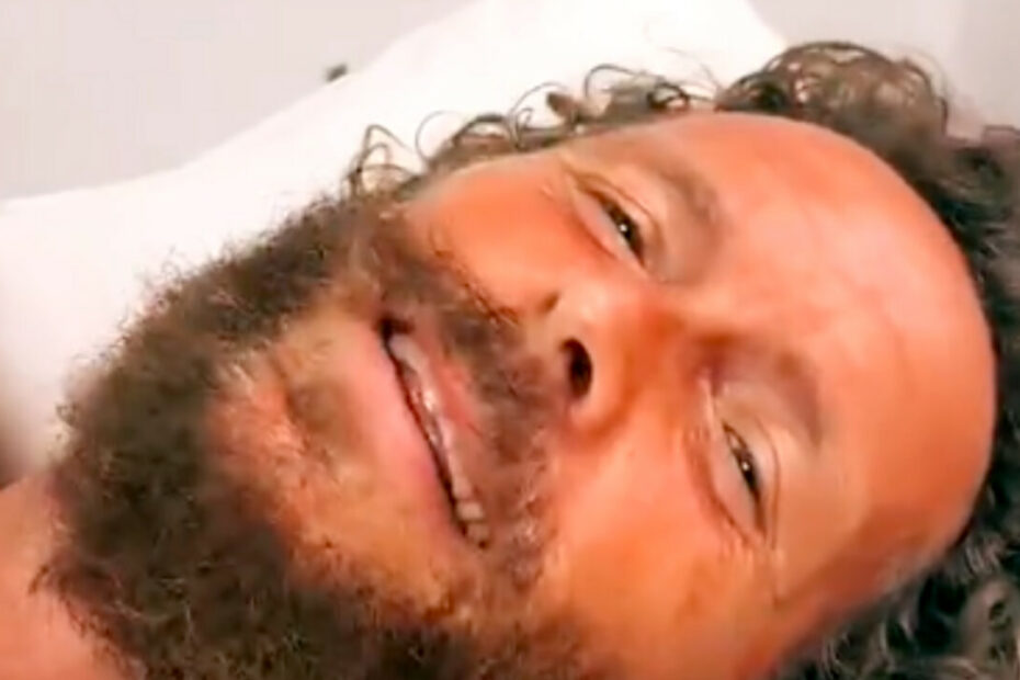 Jovanotti operato incidente bicicletta