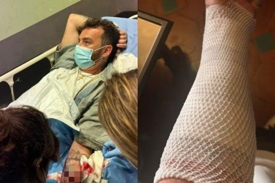 Salmo incidente perdere braccio