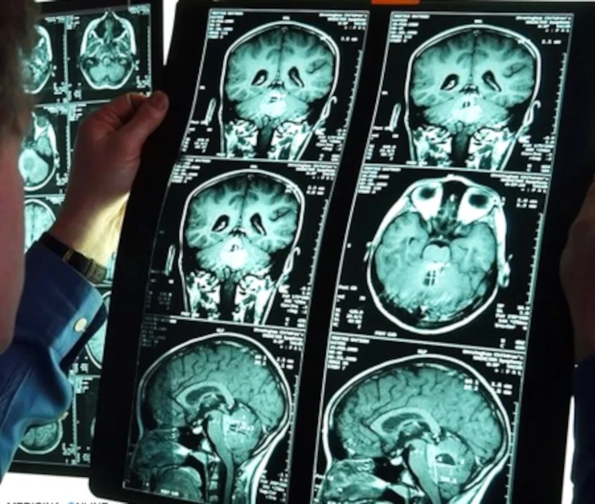 Immagine illustrativa anatomica della colonna cervicale