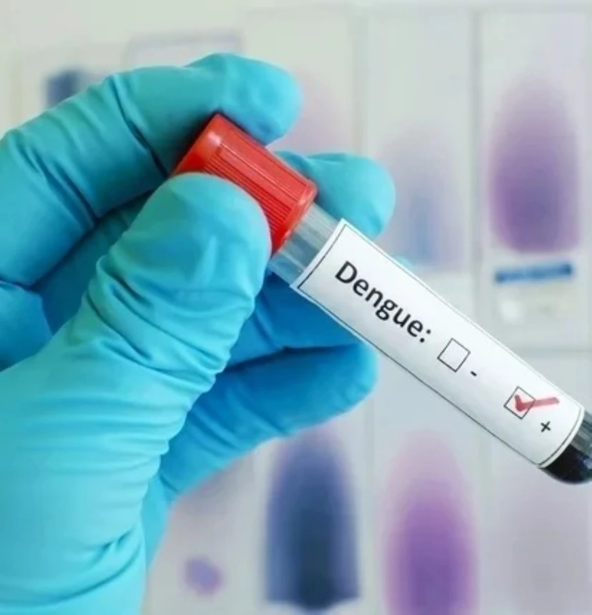 Zanzare Aedes e diffusione epidemia a Cuba