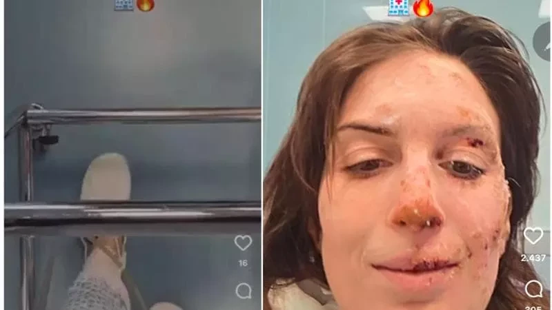 Eleonora Palmieri durante la degenza ospedaliera