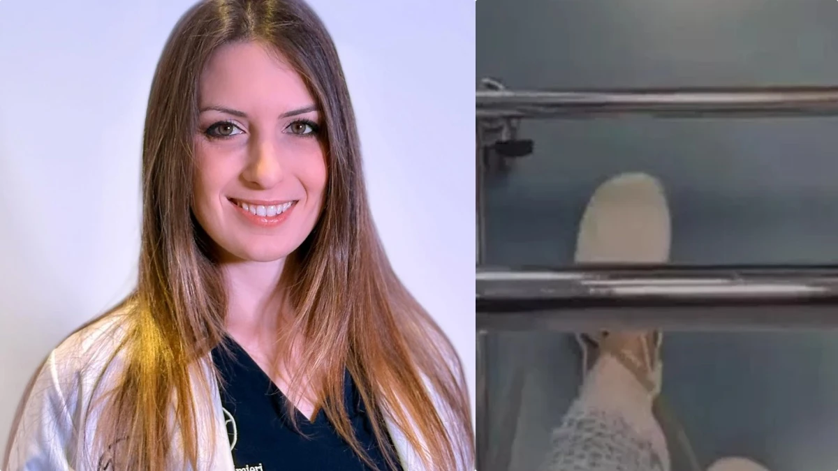 Eleonora Palmieri mostra le ustioni in ospedale