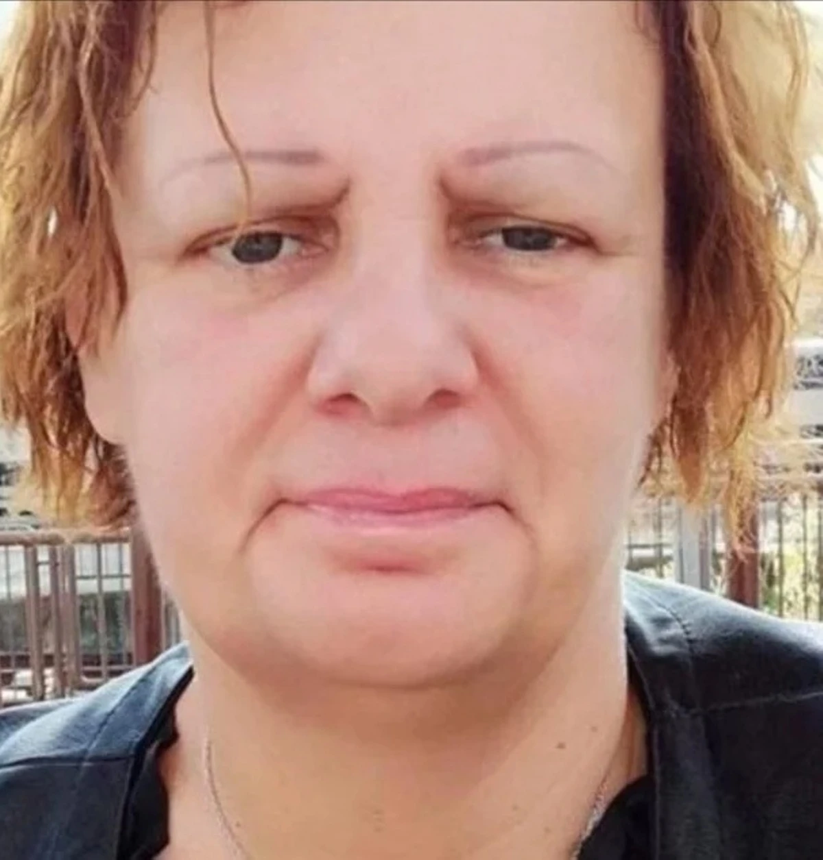 finta dottoressa visita pazienti